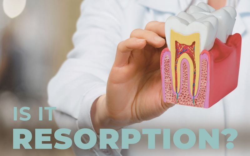 Types of Tooth Resorption, and What it Means for Your Treatment
