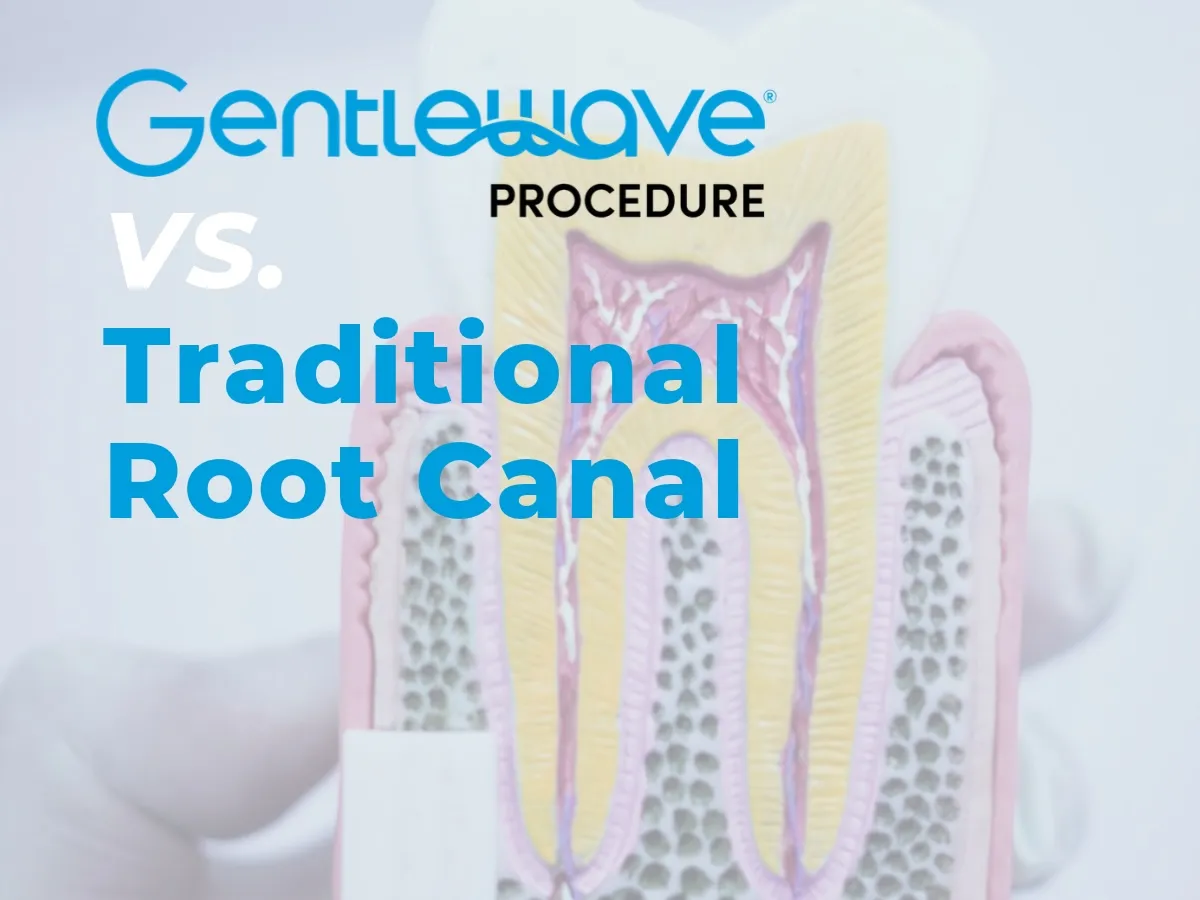 GentleWave vs Traditional Root Canal blog