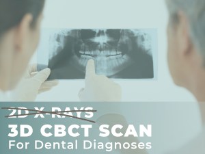 2D XRay vs 3D CBCT Scan for dental diagnoses blog